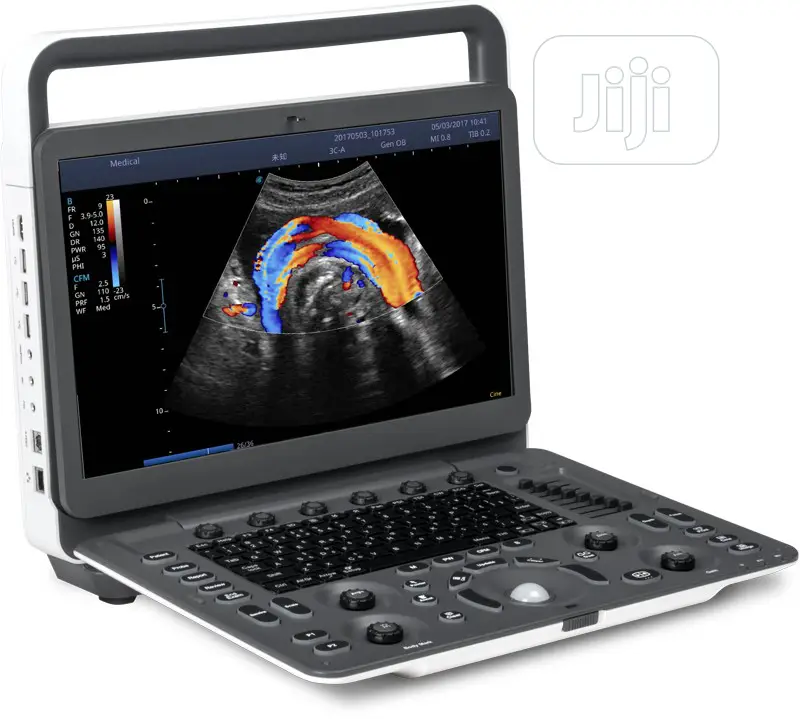 Sonoscape E2 - Ultrasound Machines(2 Probes)