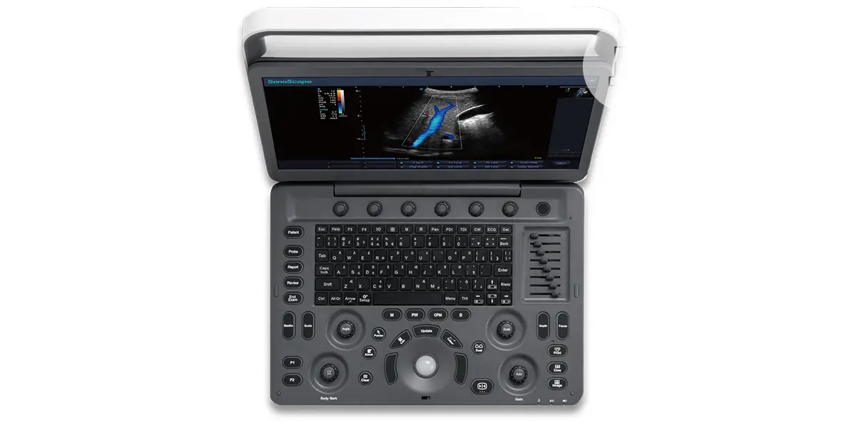 Sonoscape E2 - Ultrasound Machines(2 Probes)