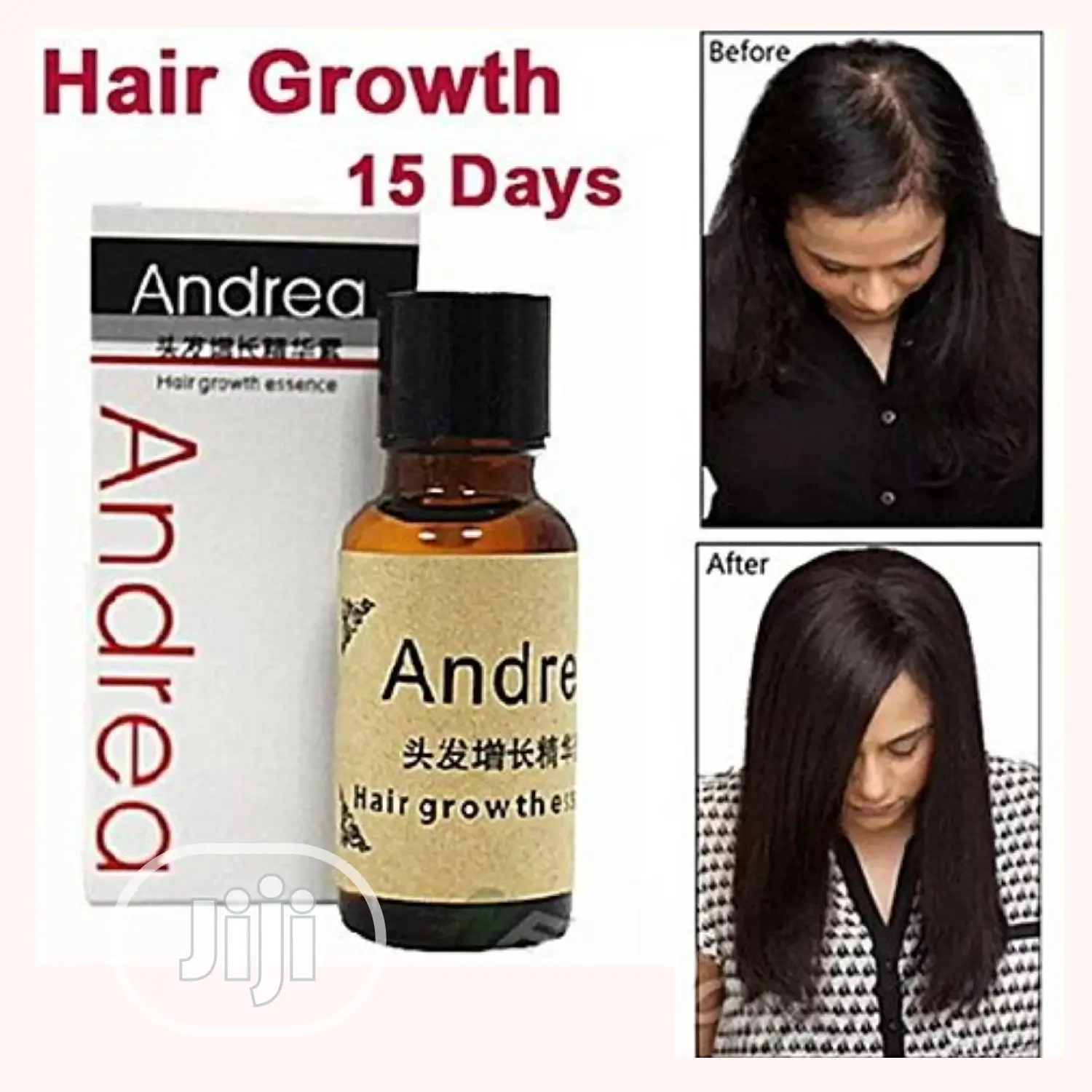 Andrea Fast Growth Essence Oil