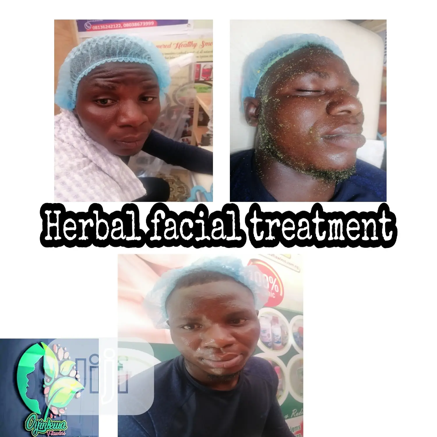 Herbal Hydrofacial Treatments