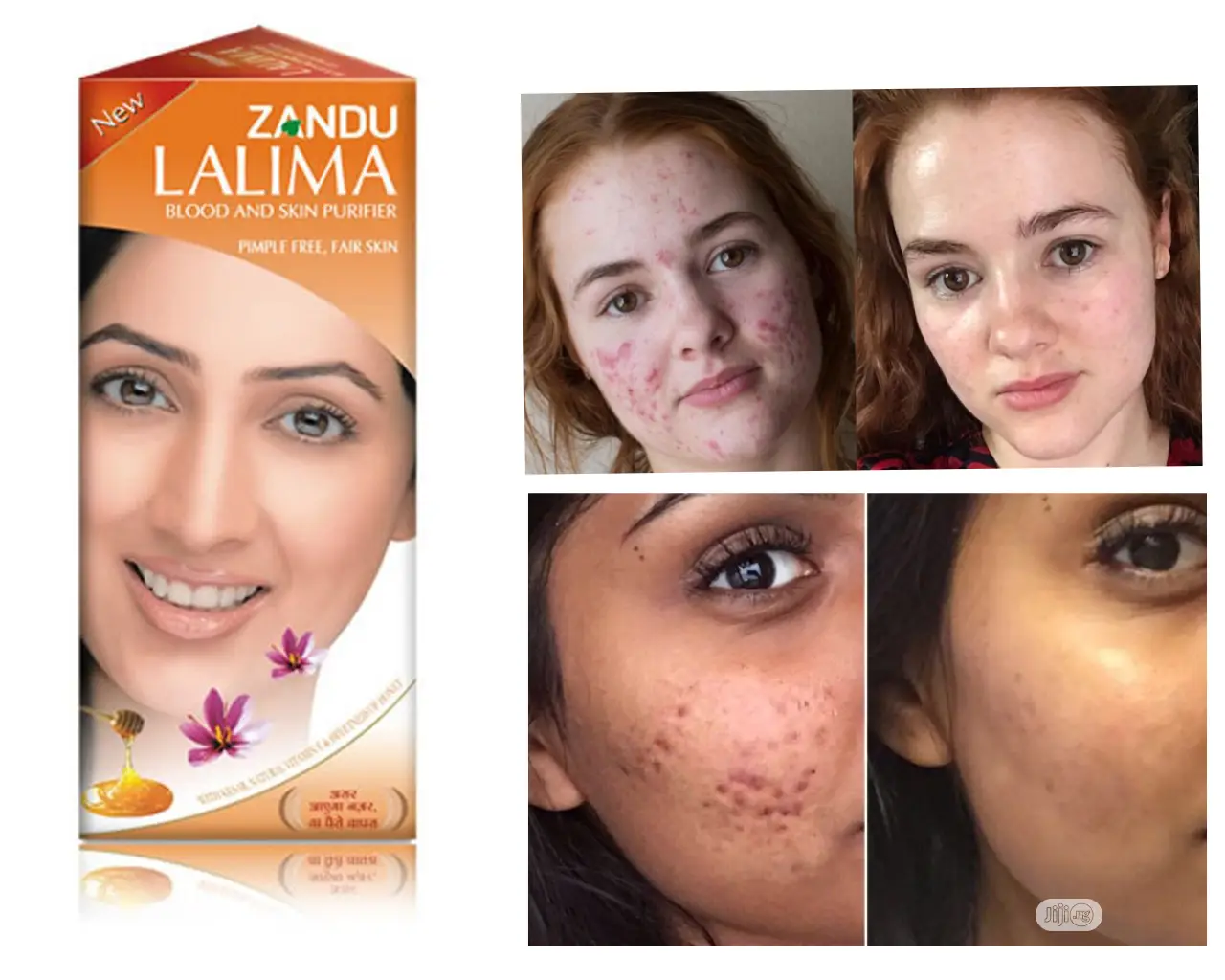 Lalima Blood And Skin Purifier