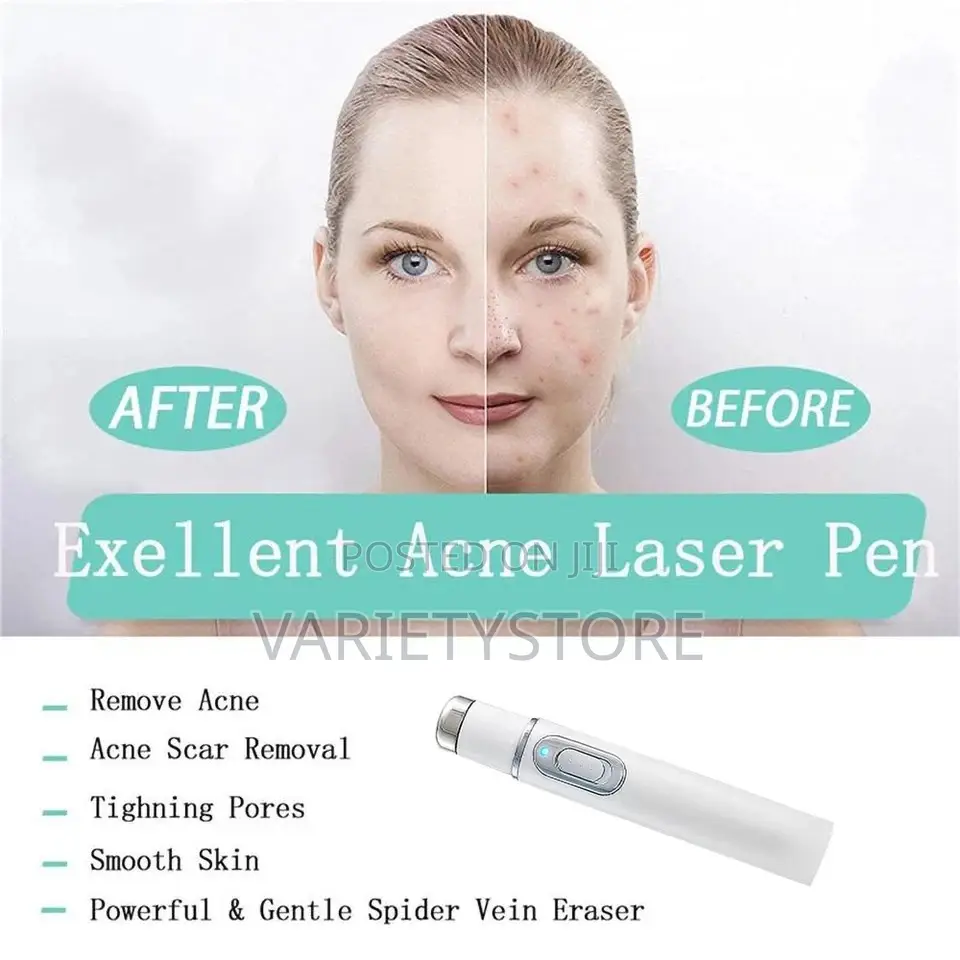 Blue Light Therapy Laser Pen Spider Vein Acne Removal Tool