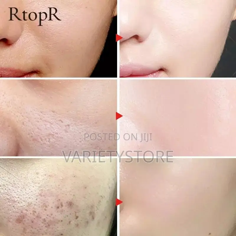 Rtopr Collagen Pore Repair Serum