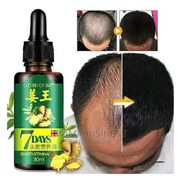 7 Days Ginger Germinal Essential Oil Hair Growth 30ml