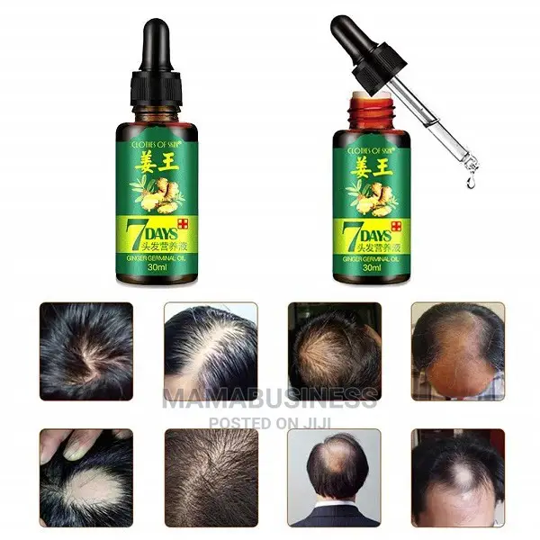 7 Days Ginger Germinal Essential Oil Hair Growth 30ml