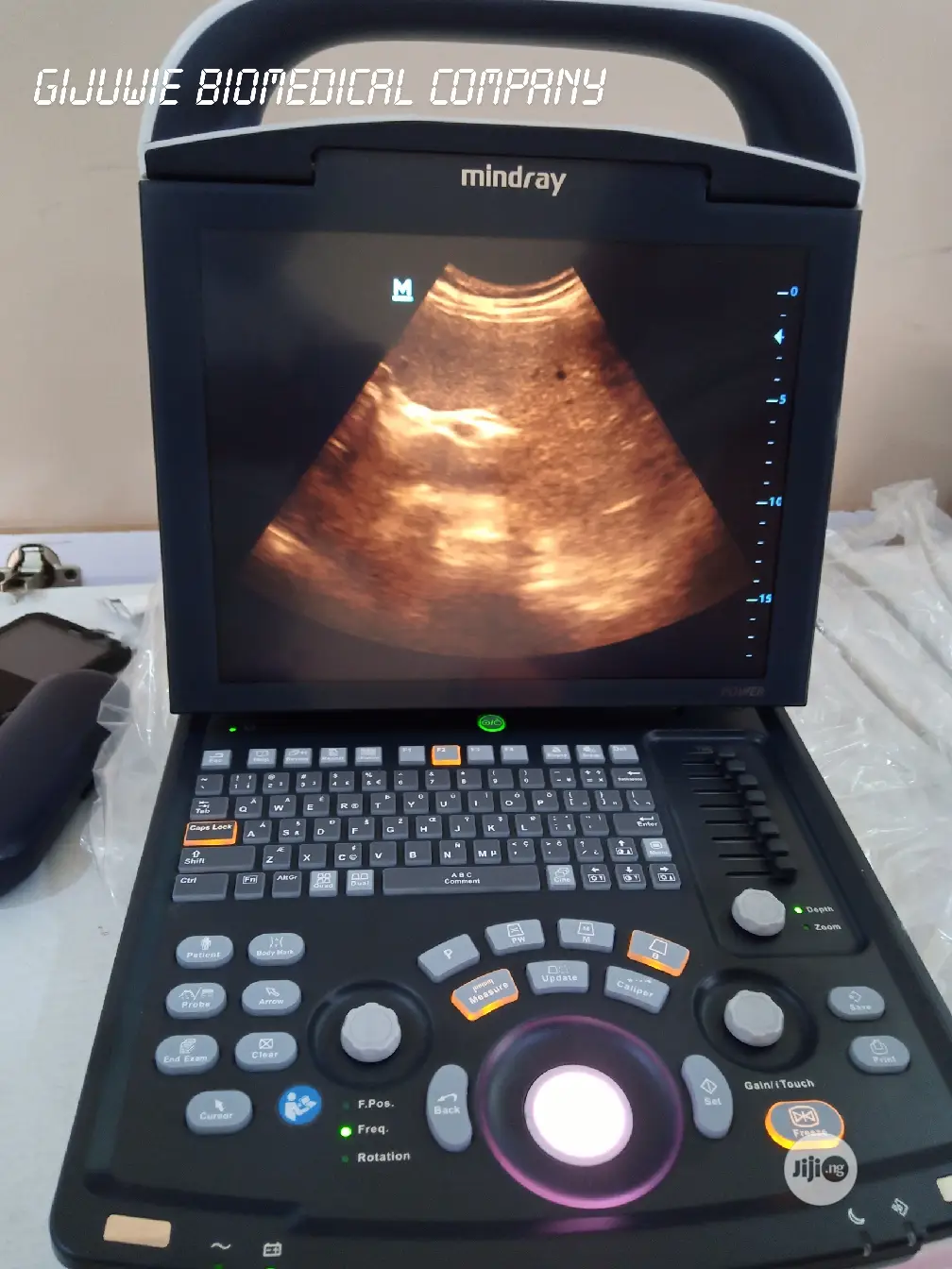 Mindray Dp10 Ultrasound Machine