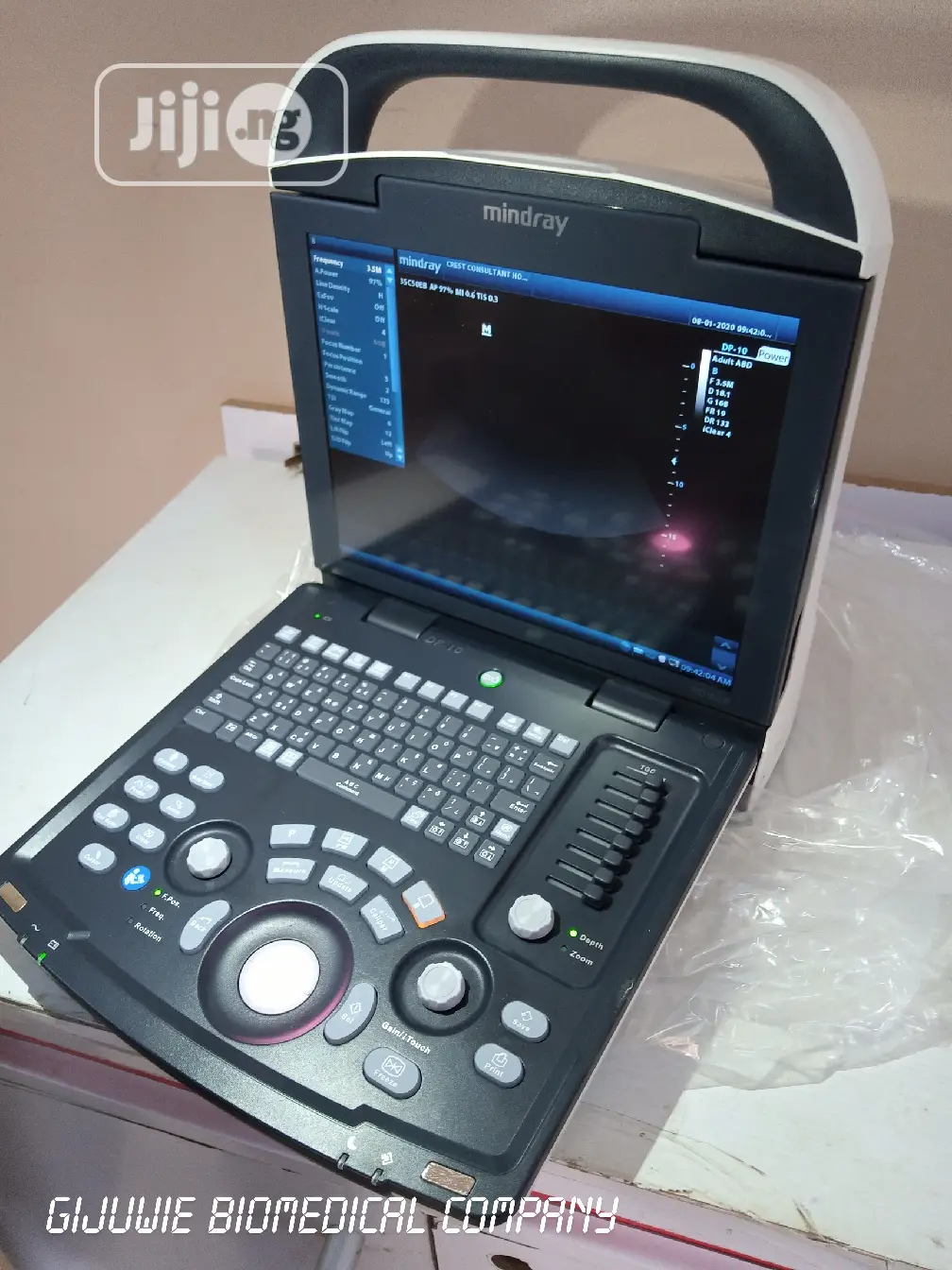 Mindray Dp10 Ultrasound Machine