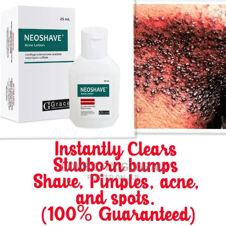 Neo Shave Acne Lotion. Stubborn Bumps Shave, Pimples, Acne.