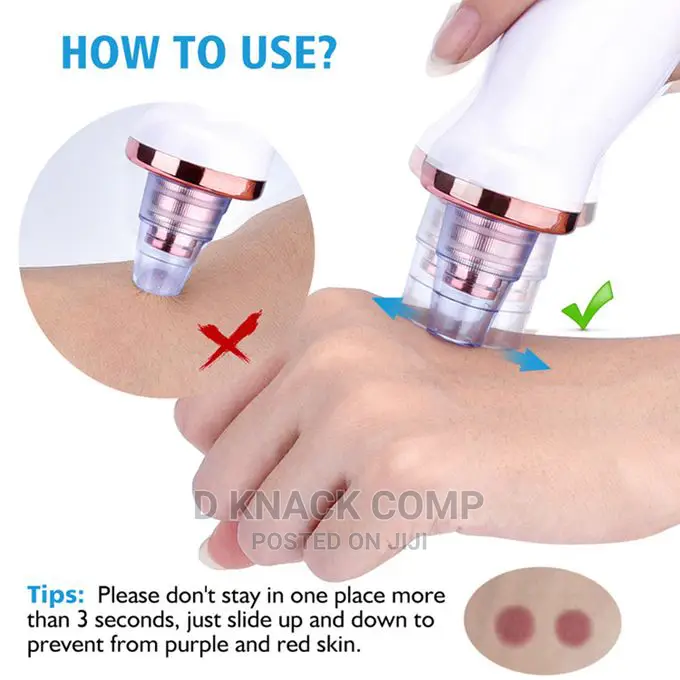 Electric Blackhead Remover Suction With 5 in 1 Pimple Zit