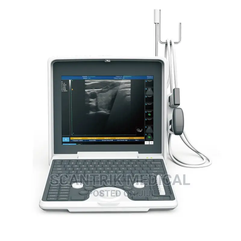 Digital Cheapest Portable Laptop B/W Ultrasound Scanner