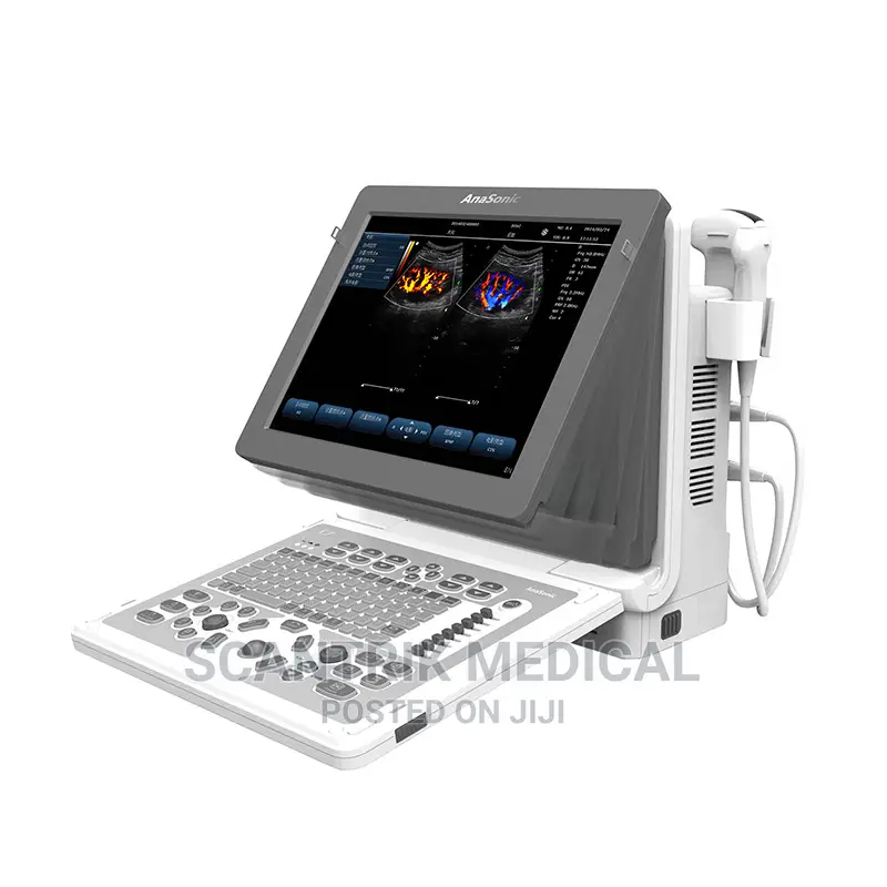 Black and White Portable Ultrasound Scanner
