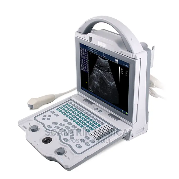 Laptop Ultrasound Equipment