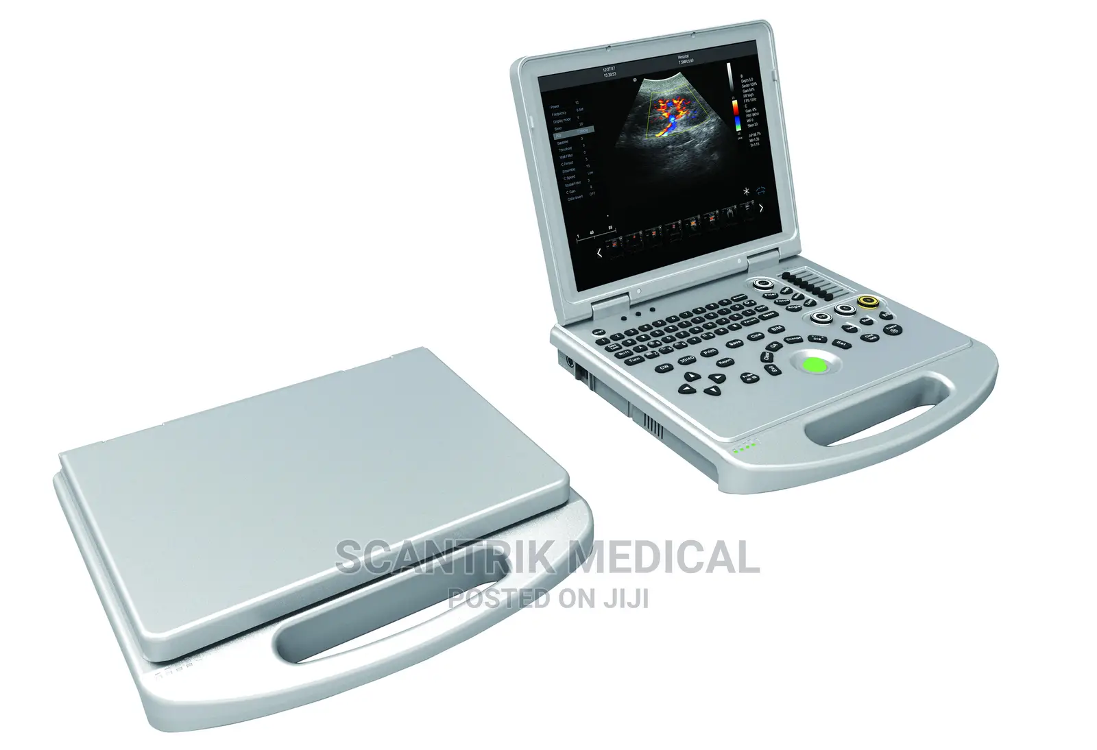 Affordable and Cheap Ultrasound Machine Laptop