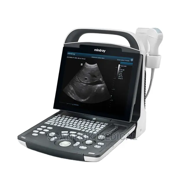 Best Ultrasound Machine Laptop