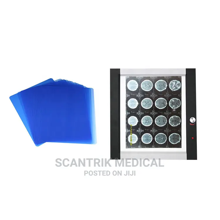 Professional Viewing Medical Film Viewer X-ray Box