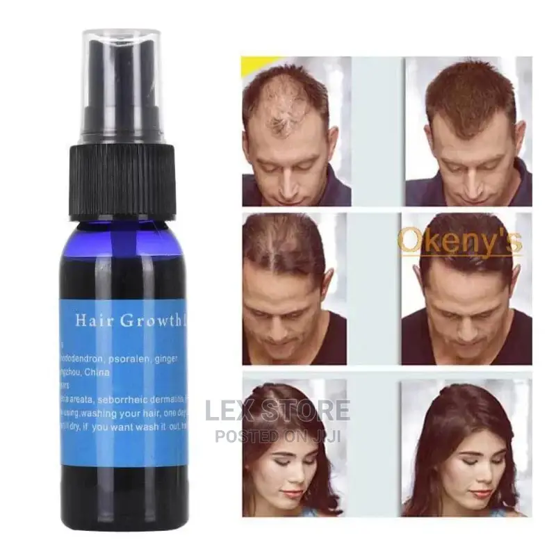 Hair Growth Essence Spray, Minimum of 10 Pcs