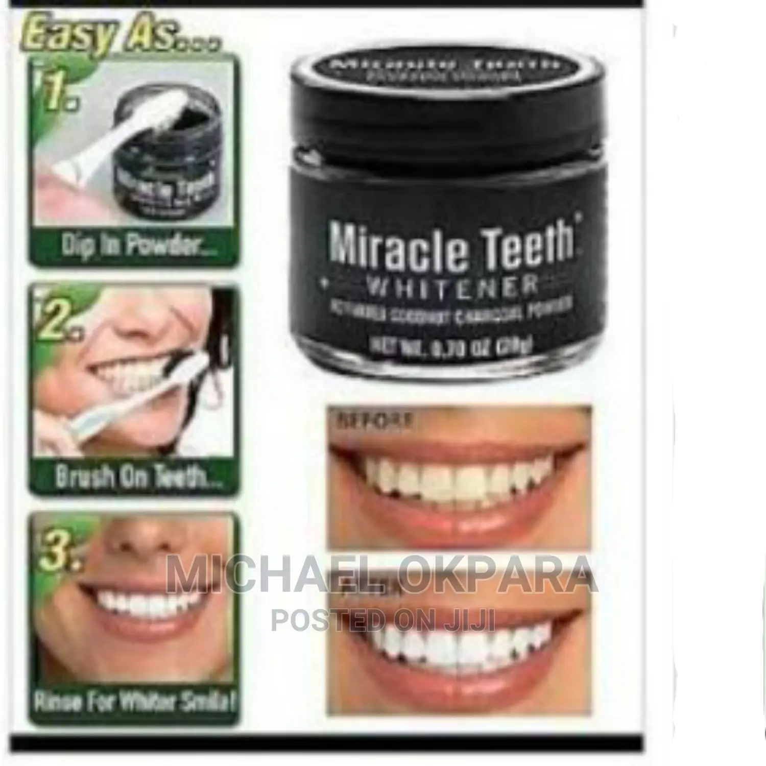 Miracle Teeth Whitener