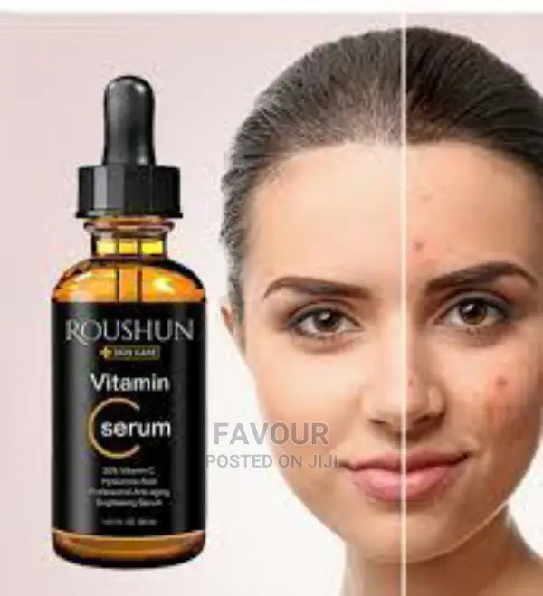 Roushun Vitamin C Blackspots, Pimples Serum-30ml