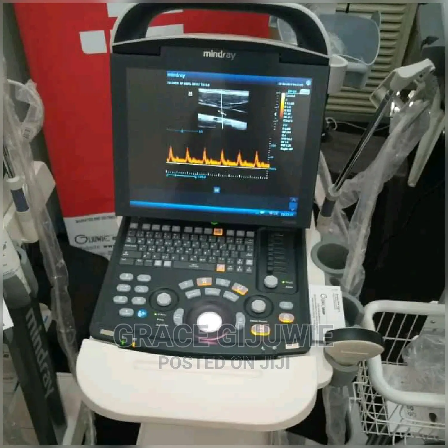 Mindray Dp10 Ultrasound Machine