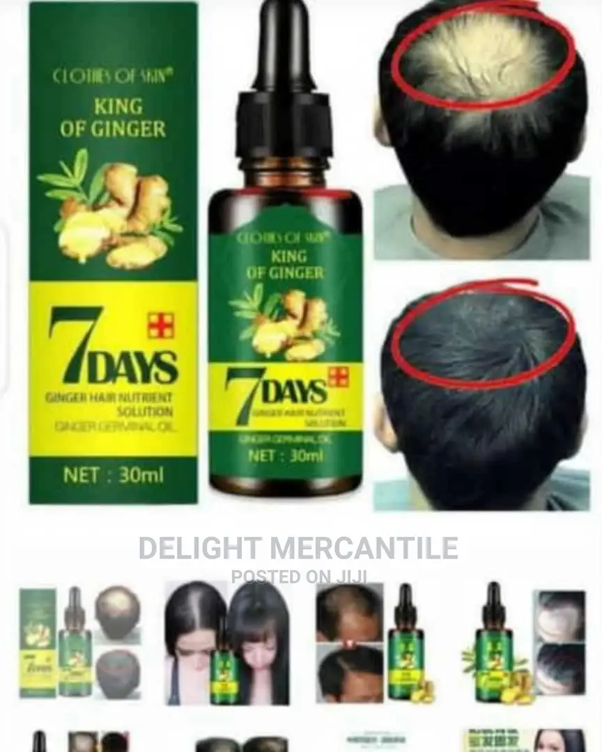 7days Ginger Hair Growth Oil Bald Hair Restoration Booster