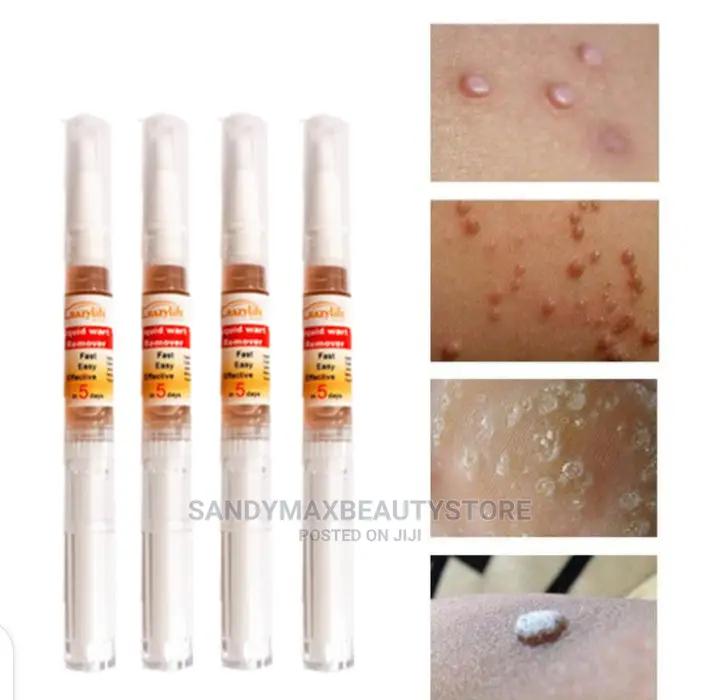 Liquid Wart And Skin Tag Remover