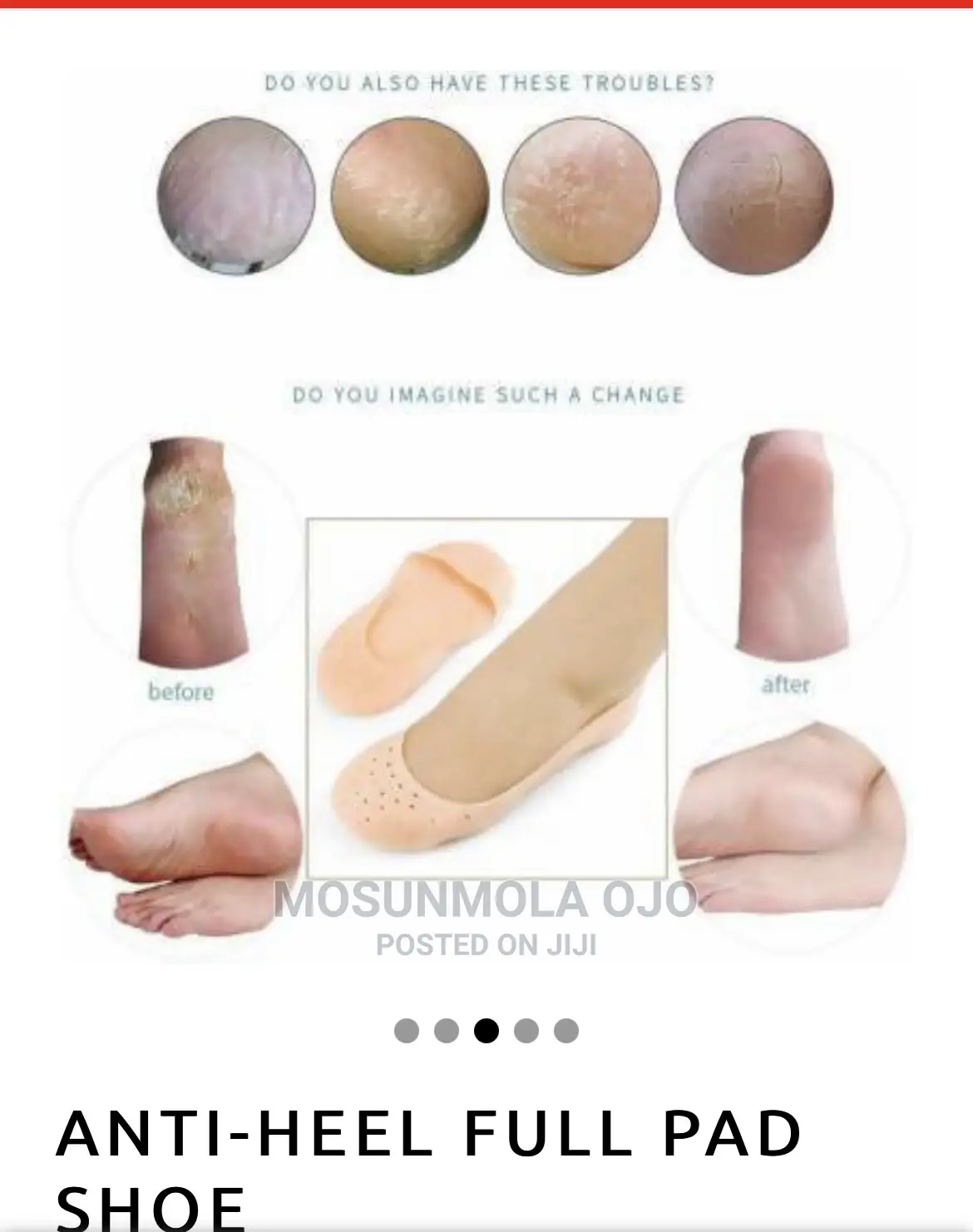 Silicone Pain Relief Slip-On Pads for Crack Feet