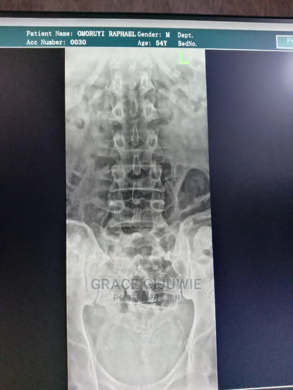 Brand New Digital Mobile X-Ray