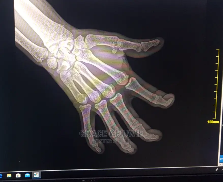 Brand New Digital Mobile X-Ray