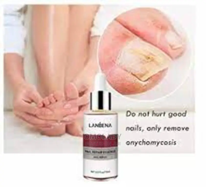 Lanbena Nail Repair Essence