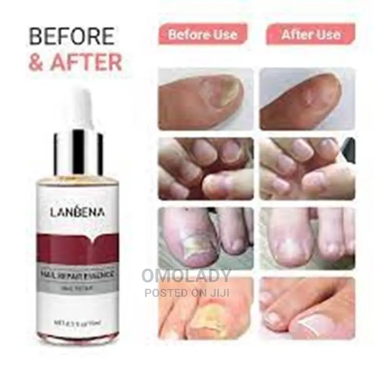 Lanbena Nail Repair Essence