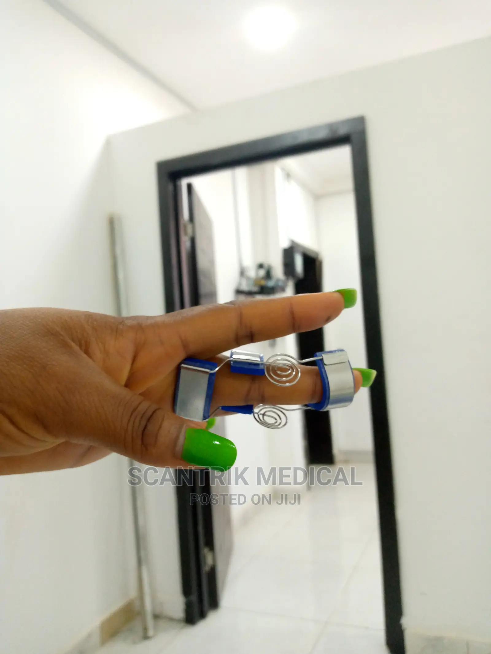 Finger Fracture Splints