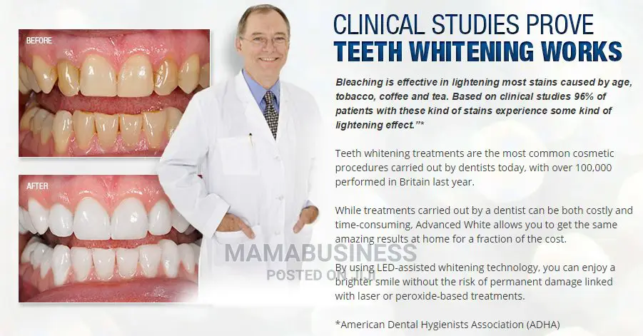 Advanced Teeth Whitening System Kit
