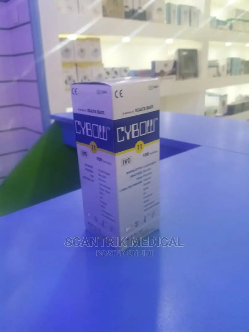 Parameters Urine Test Strips
