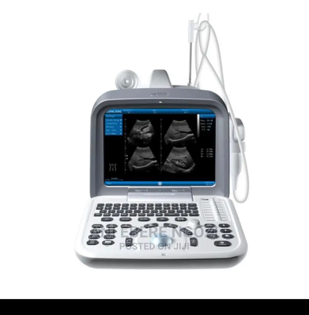 Zoncare Ultrasound Scan Machine