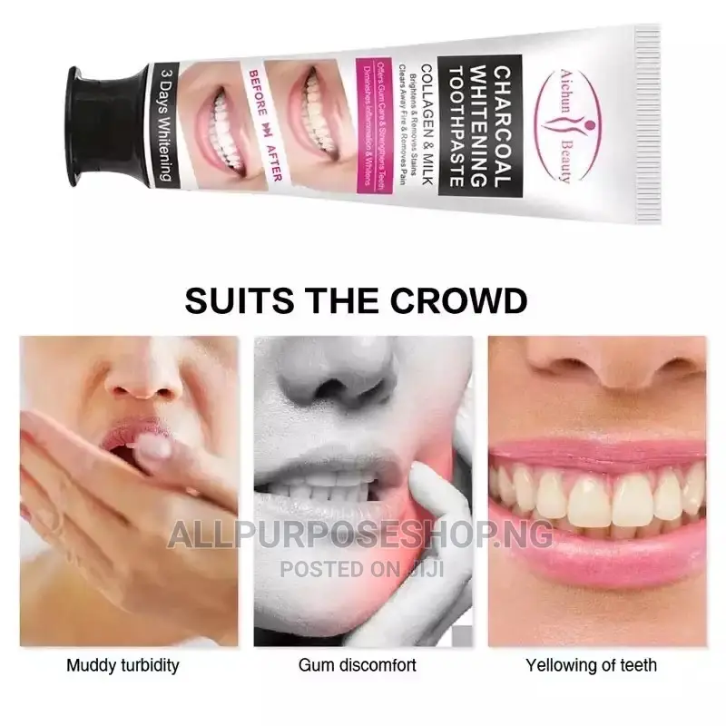 Charcoal Teeth Whitening