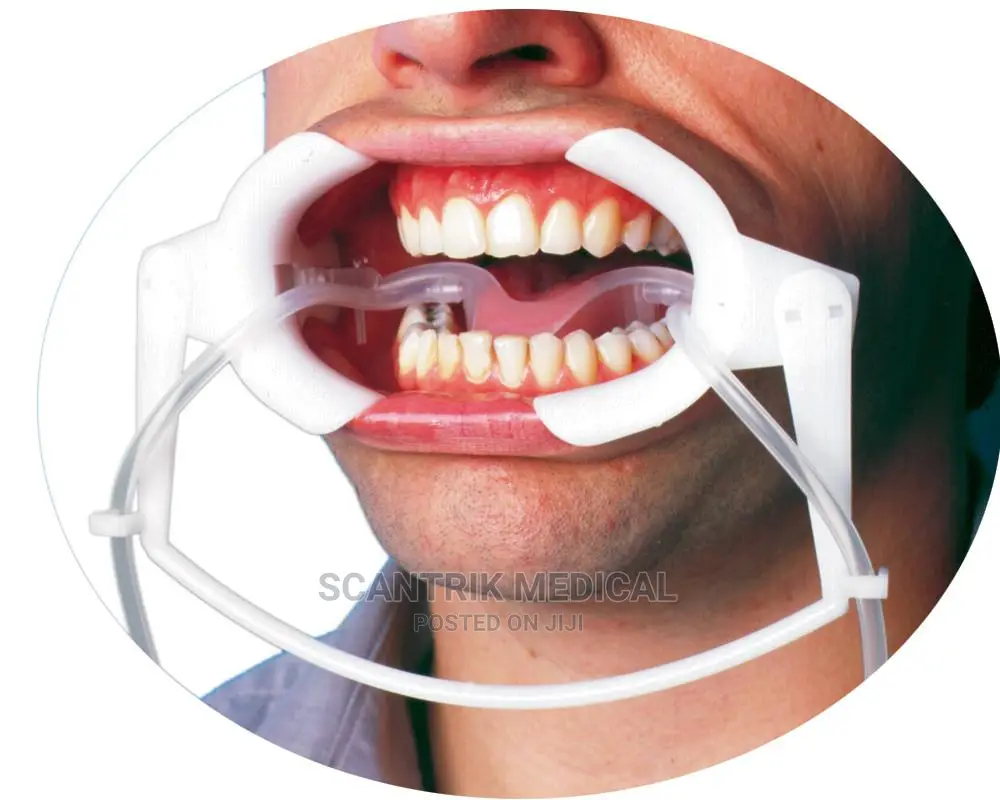 Cheek Retractor Retractors Teeth Whitening Lip Mouth