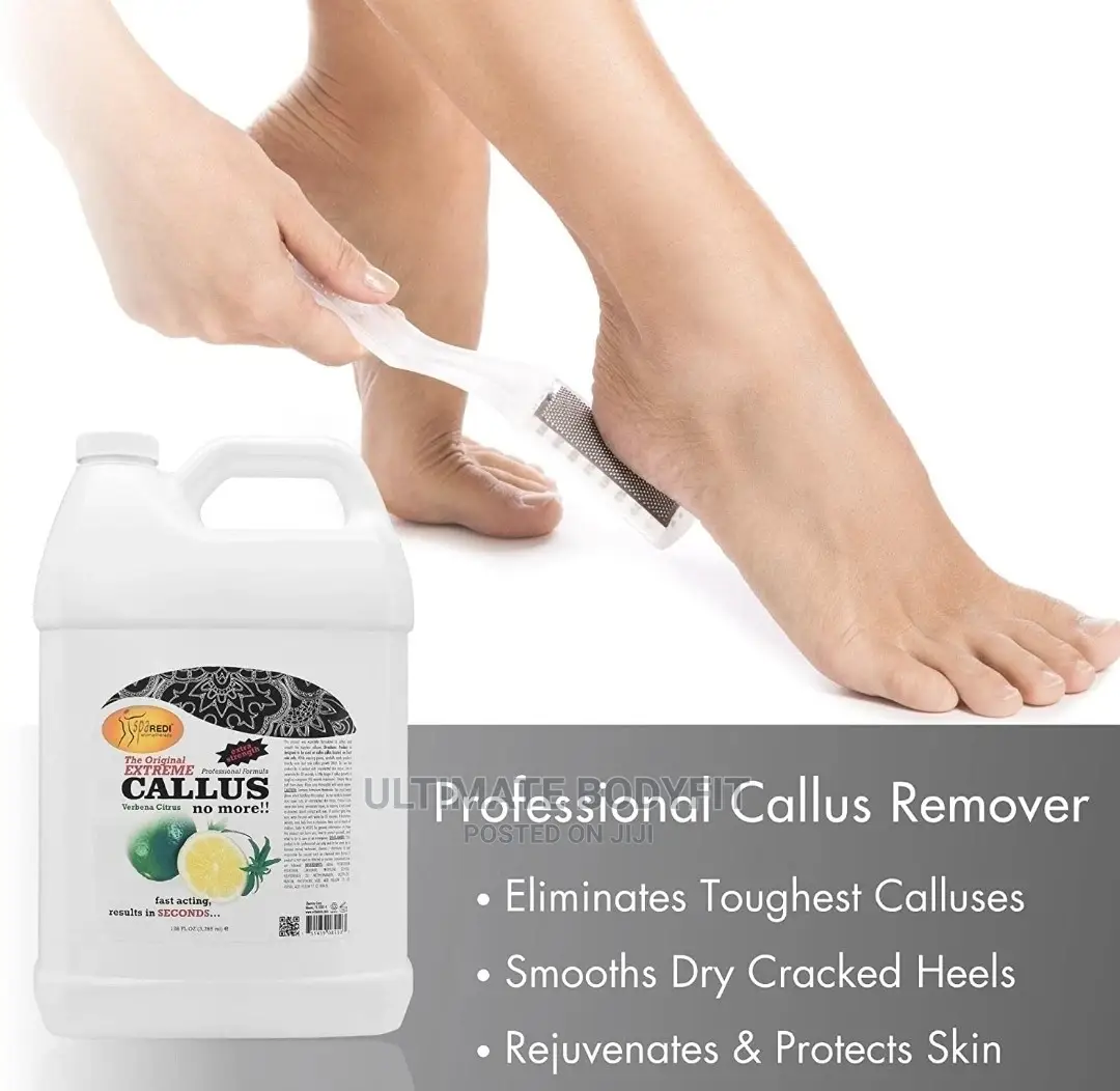 Brand New Callus Remover (Extra Scent: Lemon Lime