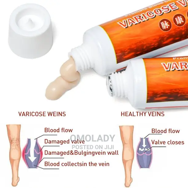 Varicose Vein Cream -20g