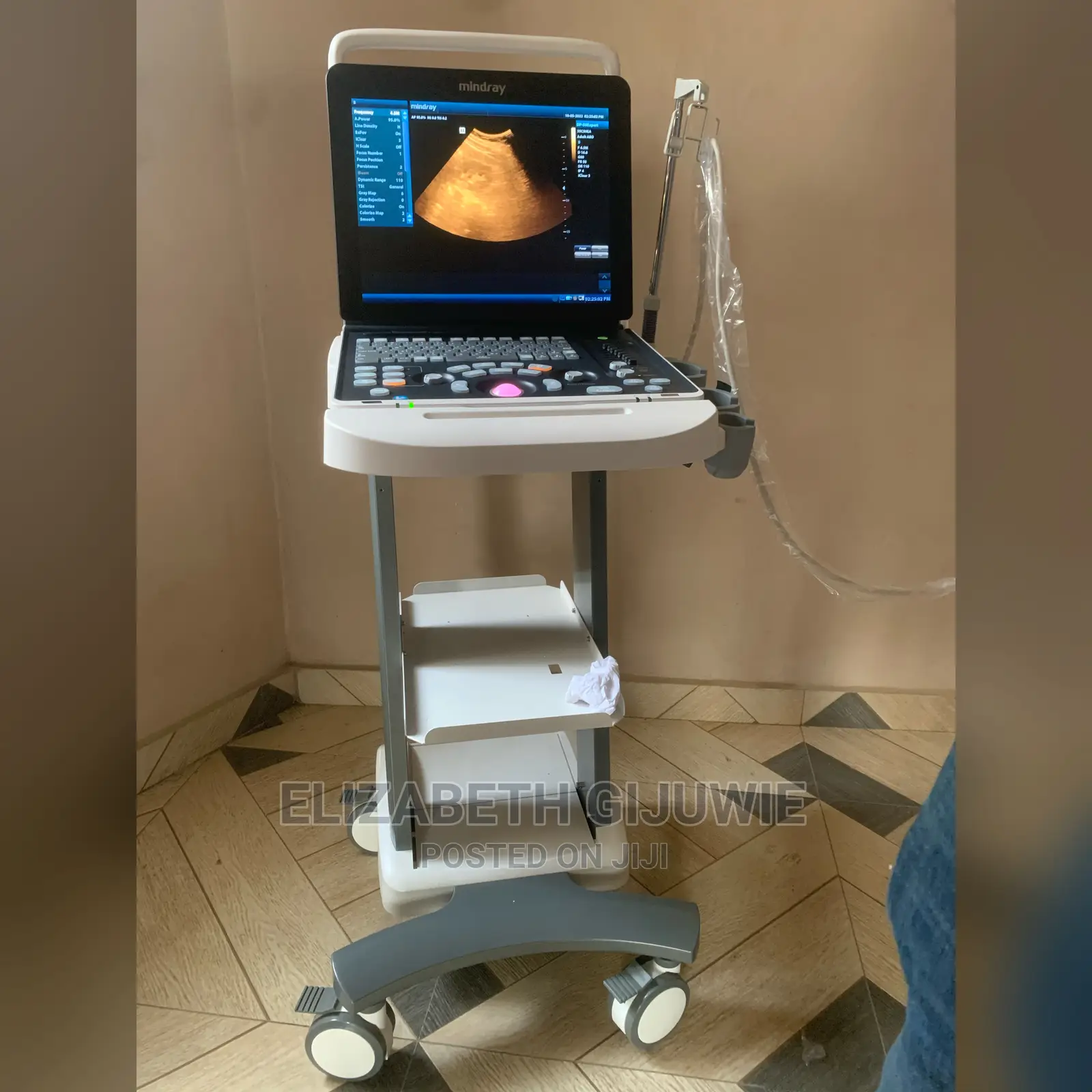 Mindray Dp50 Expert Ultrasound Machine