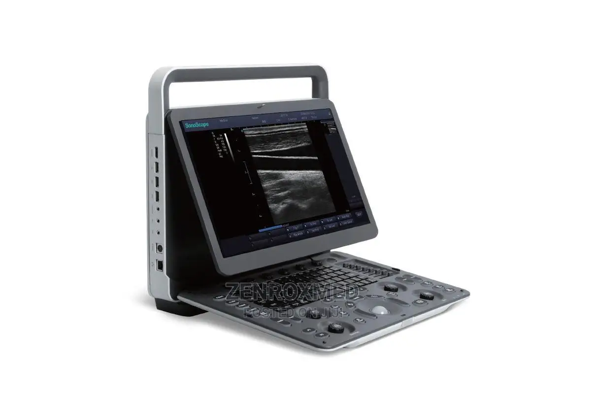 Sonoscape E1 Exp Ultrasound Nigeria