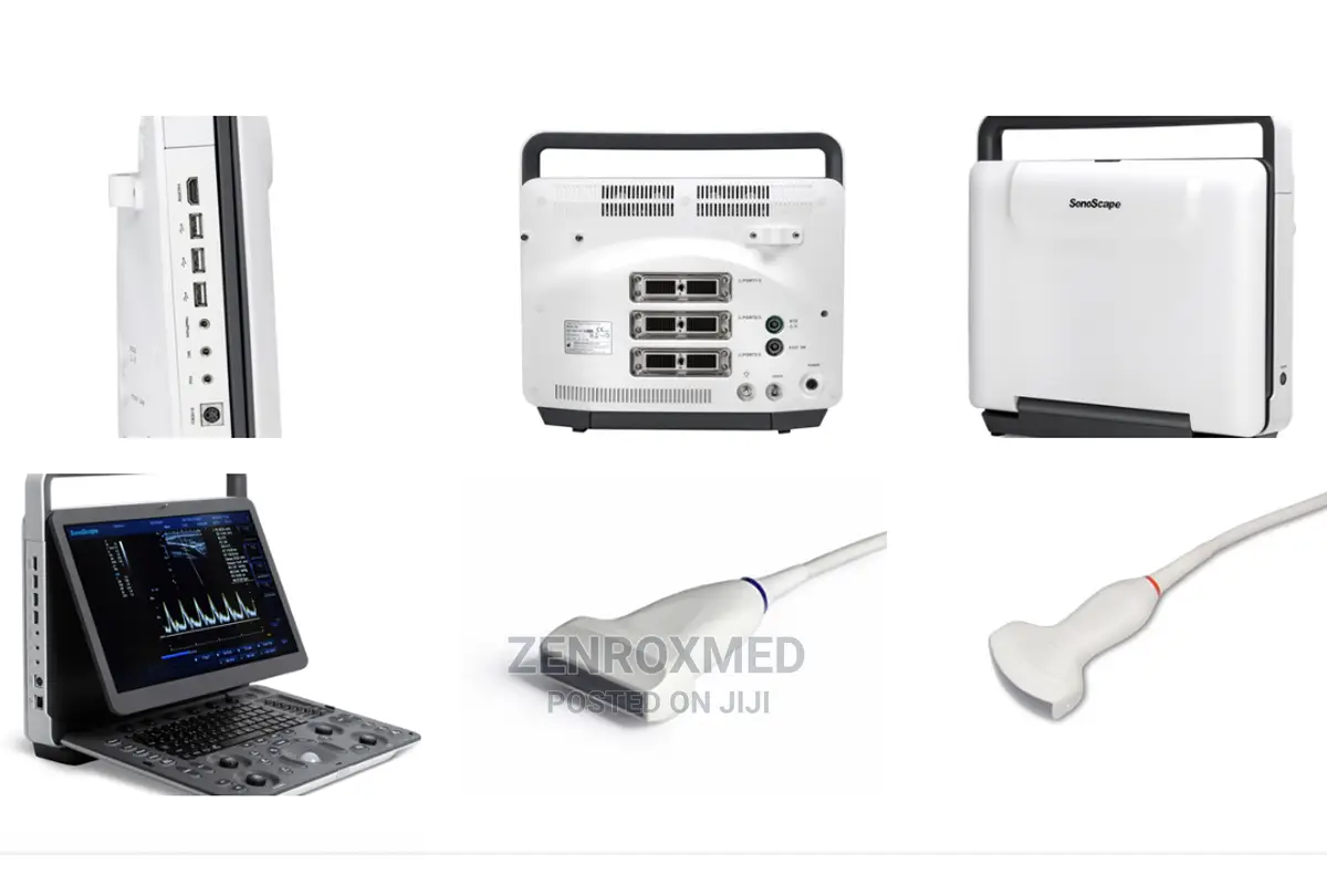 Sonoscape E1 Exp Ultrasound Nigeria