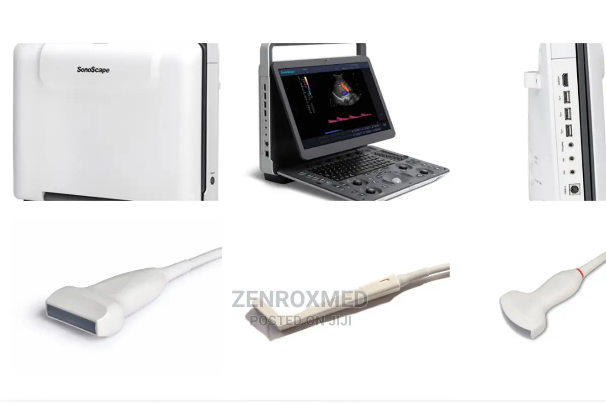 Sonoscape E2 Color Ultrasound Nigeria