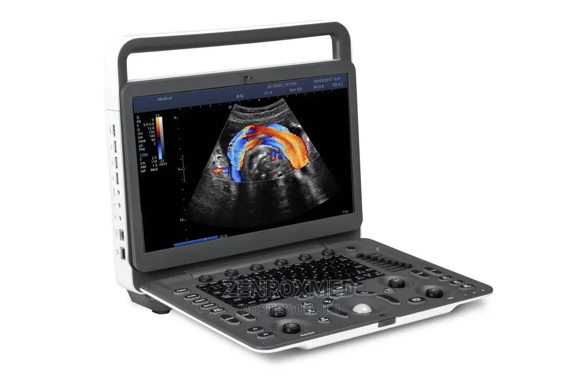 Sonoscape E2 Color Ultrasound Nigeria