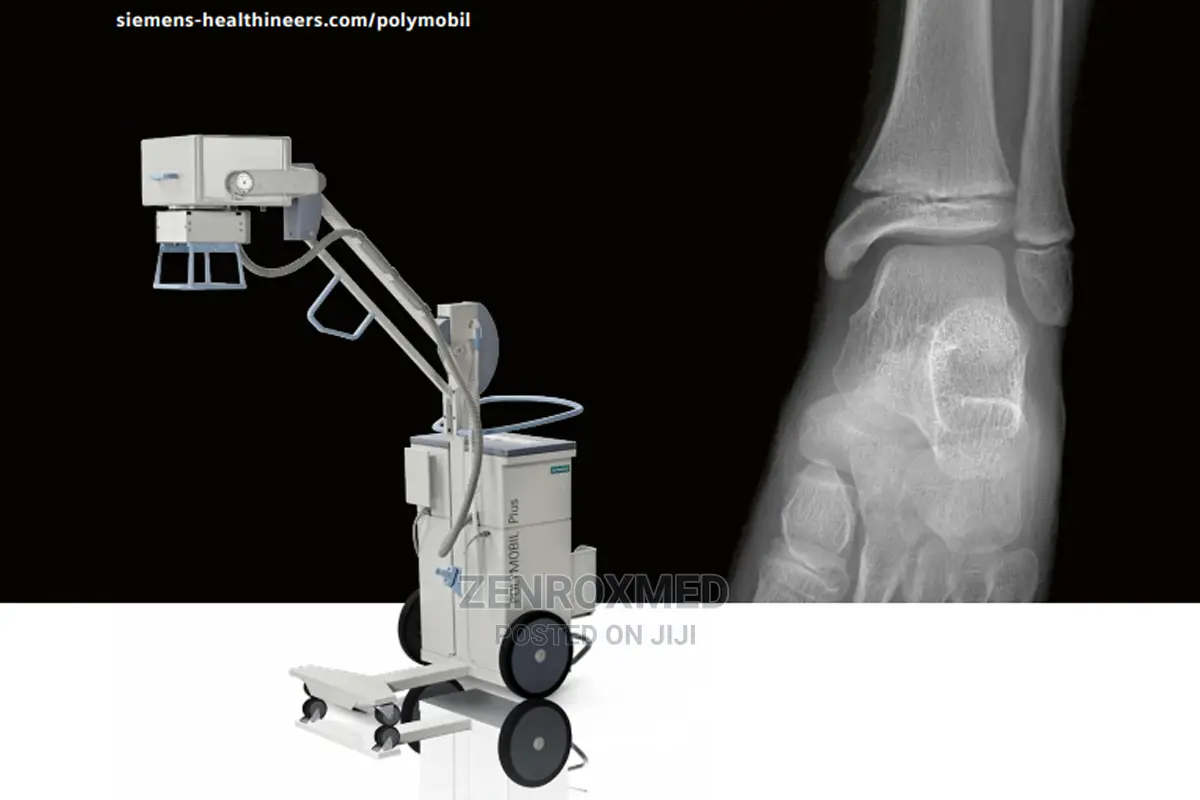 Siemens - Polymobil Plus Analogue Mobile X-Ray